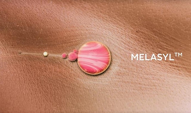 L’Oréal’den cilt lekelerine karşı çığır açan yeni molekül: Melasyl