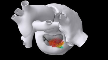 Dassault Systèmes’in FDA ile Ortak Çalışması: Klinik Deneylerde Sanal İkizlerin Kullanımına Yönelik Yenilikçi Bir Kılavuz