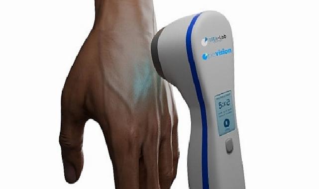 Üniversite öğrencisi babasının hastalığından yola çıkarak vitiligo tedavisi için aygıt geliştirdi