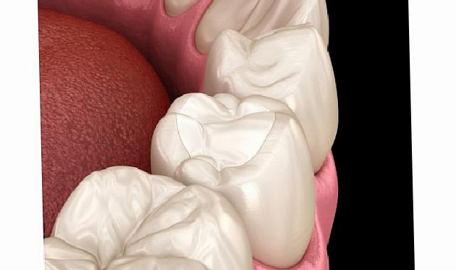 Estetik Dolguların Ömrünü Alışkanlıklarımız Belirliyor