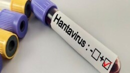 Hantavirüs Bir Salgına Dönüşür mü?